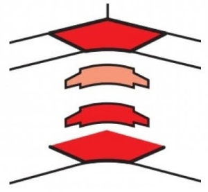 10658 Legrand DLP Угол внешний для 220/195х65 на 3 секции